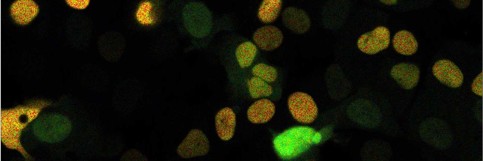 microscopy image of nuclear biosensor indicating cell cycle stage