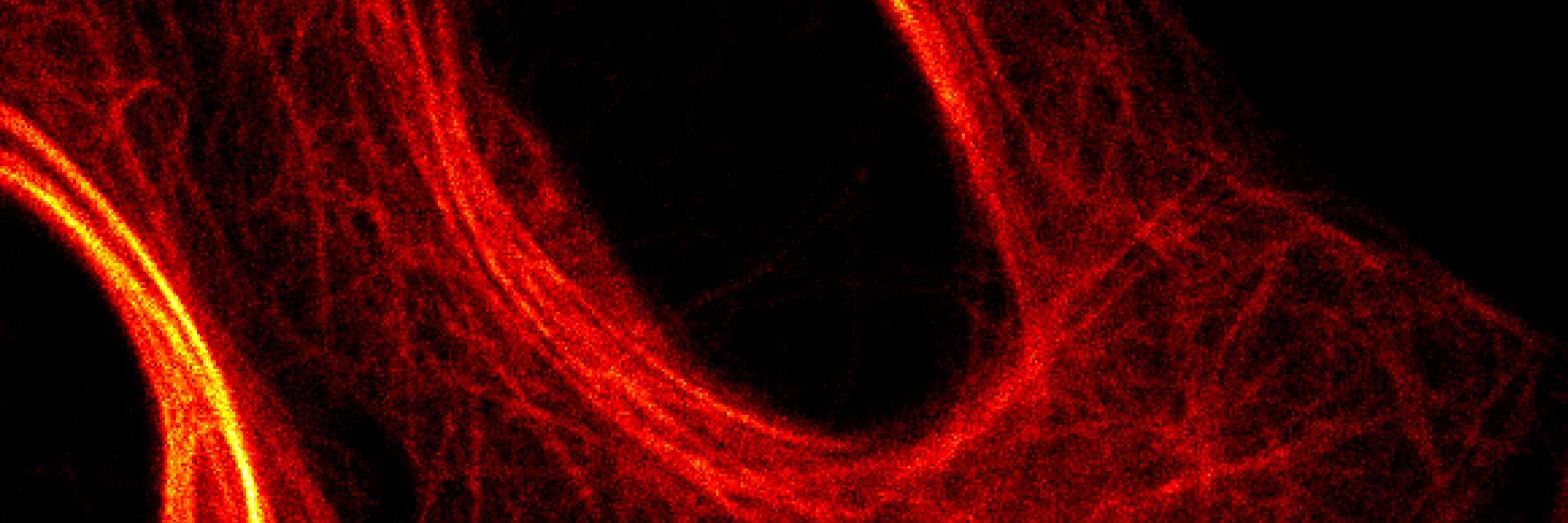 microscopy image of microtubule network 